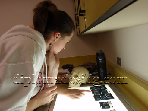 curso diplomado odontolog&iacute;a medicina forense legal medicina derecho m&eacute;dico - La odontolog&iacute;a forense permite la identificaci&oacute;n de cad&aacute;veres, La Odontolog&iacute;a Forense relaciona al odont&oacute;logo con el sistema judicial, lo cual se ve reflejado mediante las pericias. Las pericias de los odont&oacute;logos forenses son un aporte a las ciencias forenses